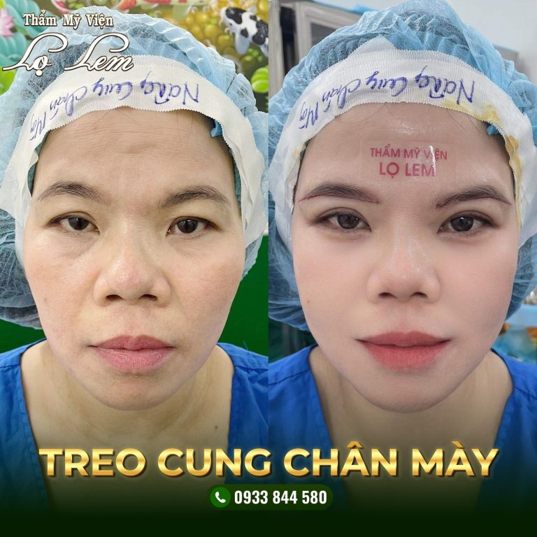 485794135_682951900971489_5179350487636228040_n Treo cung chân mày tại Lọ lem