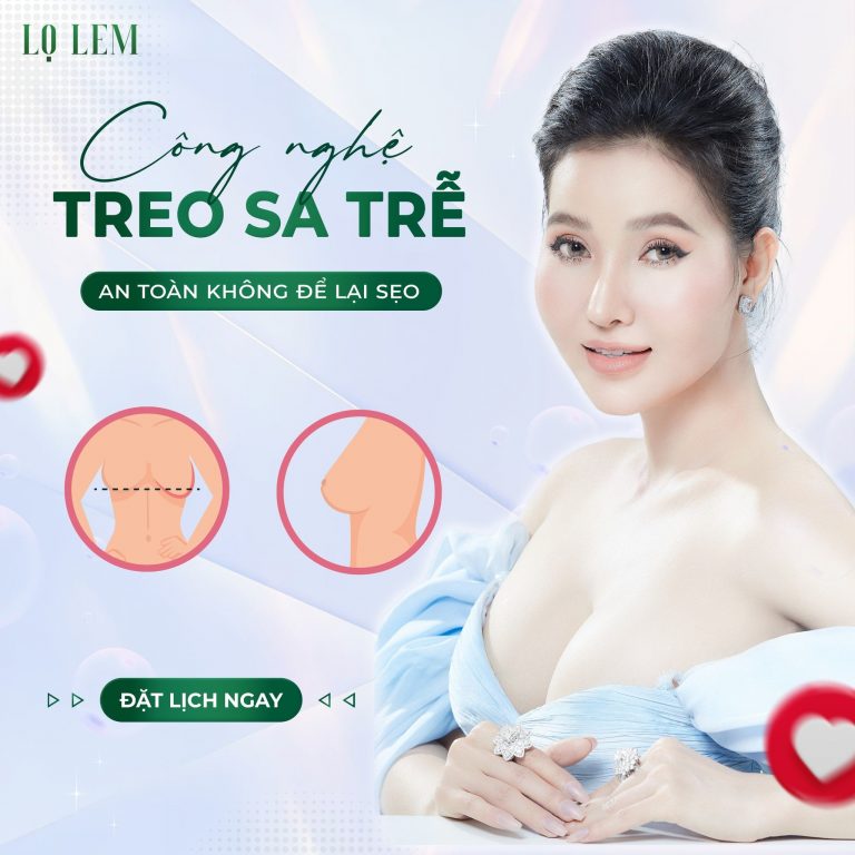 486428216_683750027558343_430362983358202691_n Treo ngực sa trễ tại Lọ Lem