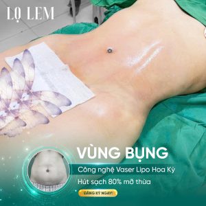 tạo hình thành bụng đẹp và an toàn tại Lọ Lem