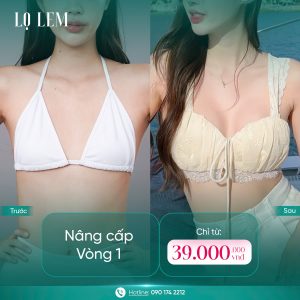 Khách hàng nâng cấp vòng 1 tại Lọ Lem