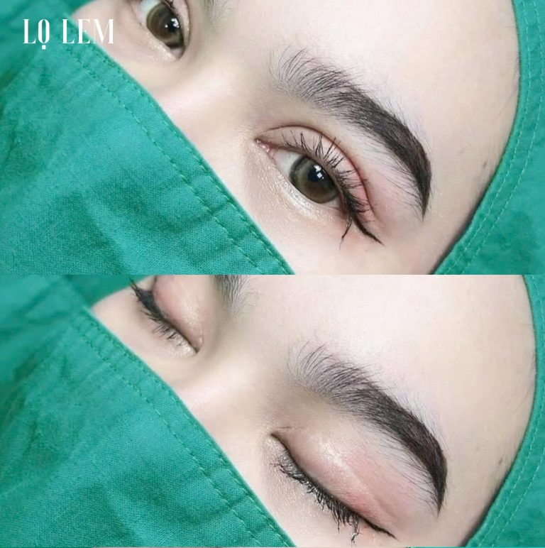 Top 7 địa chỉ nâng cung chân mày uy tín tại TP.HCM Top 7 địa chỉ cắt mí uy tín tại TP.HCM