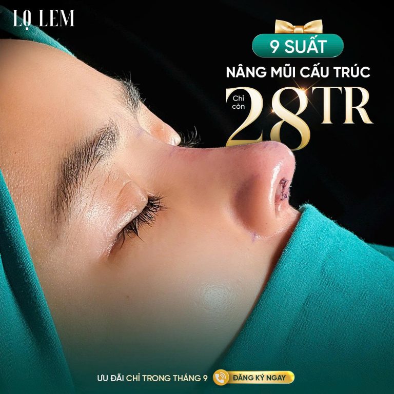 549779043_824886206778057_7943486281671485998_n Nâng Mũi Cấu Trúc Trung Hoa chỉ còn 28 Triệu tại Lọ Lem