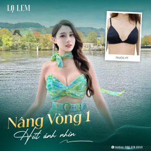 nâng ngực đẹp và an toàn tại Lọ Lem