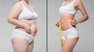 hút mỡ bụng an toàn