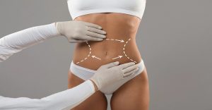 tạo hình thành bụng đẹp