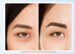 Nhấn Mí Bao Nhiêu Tiền? Top 7 Thẩm Mỹ Viện An Toàn TP. HCM