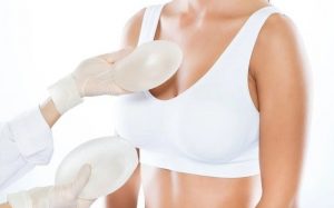 Những Lưu ý Khi Nâng Ngực. Địa Chỉ Nâng Ngực Uy Tín Tại Tphcm