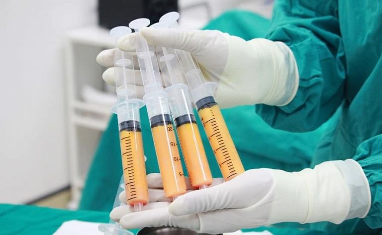 Bảng Giá Cấy Mỡ Tự Thân Chi Tiết Tại Các Cơ Sở Uy Tín Tp.hcm