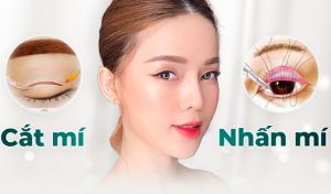 Nhấn mí và cắt mí khác nhau như thế nào? Bảng giá mí plasma