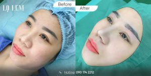 nâng cung chân mày tại Lọ Lem