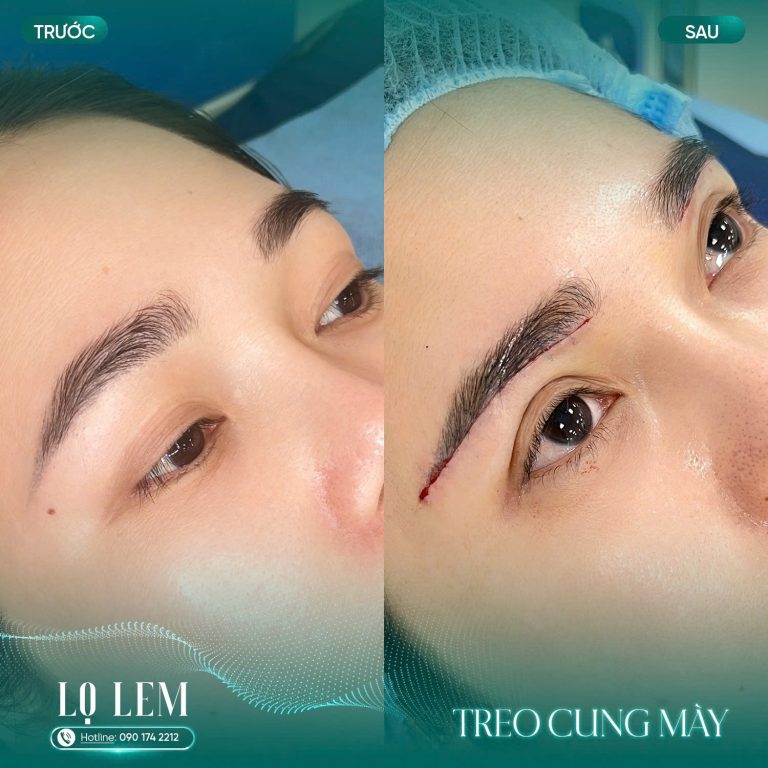 z7187849957169_e2e5c3f40aa1e452731f2f91b4ebfc2c treo cung chân mày tại Lọ Lem