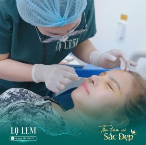 Nâng Mũi Cấu Trúc Trung Hoa Là Gì? Xu Hướng Mũi Hot Trend 2026