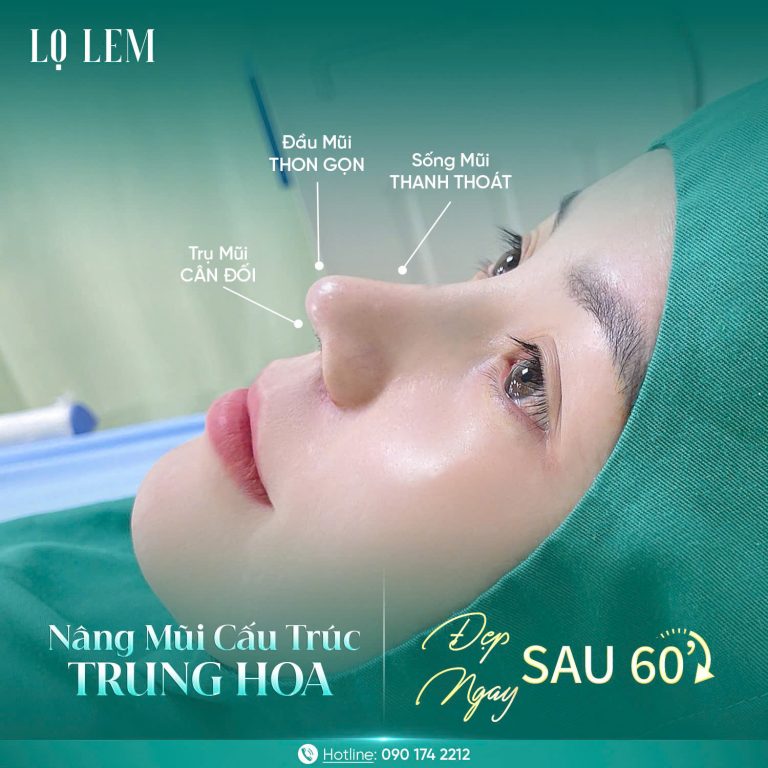 Nâng Mũi Cấu Trúc Là Gì? Lý Do Nên Chọn Để Mũi Đẹp Tự Nhiên