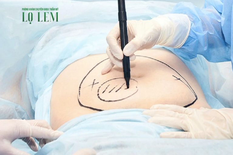 Top 7 Địa Chỉ Hút Mỡ Bụng Uy Tín Và An Toàn Tại Tp.hcm