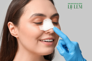 Sửa mũi hỏng ở đâu đẹp, an toàn TPHCM Sửa mũi hỏng ở đâu đẹp, an toàn TPHCM