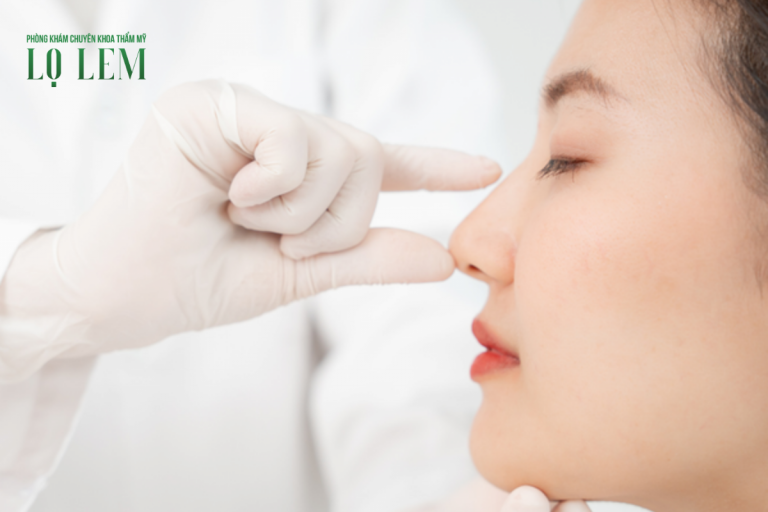 Nâng mũi cấu trúc giá bao nhiêu? Nâng mũi cấu trúc giá bao nhiêu?