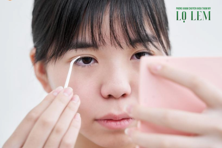 Điều trị sụp mí ở đâu TP.HCM?