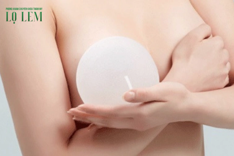 địa chỉ nâng ngực uy tín tại quận Tân Bình.