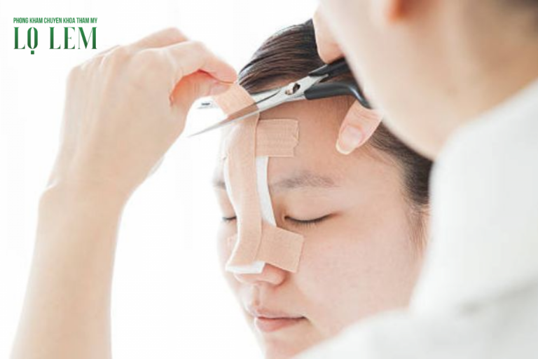 Hướng dẫn giảm sưng nhanh sau nâng mũi an toàn, đúng cách