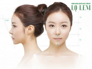 Những ai không nên nâng mũi? Cần lưu ý điều gì?