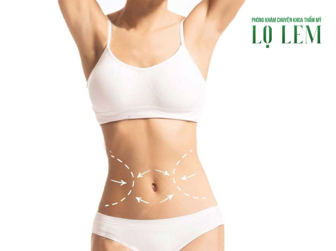 Hút Mỡ Ở Đâu Tốt? 3 Điều Cần Biết Khi Chọn Địa Chỉ