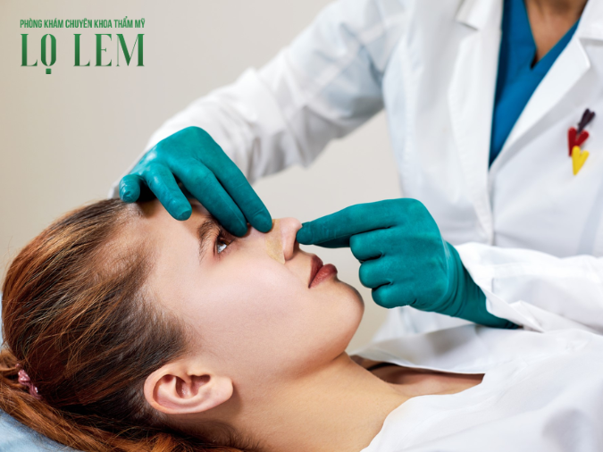 Nâng mũi bao nhiêu ngày có thể tháo nẹp? Địa chỉ tại Tân Bình