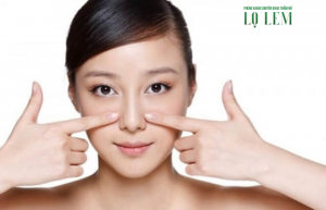 Thu Gọn Xương Mũi Bè ở đâu Chuẩn Y Khoa Tại Tân Bình?