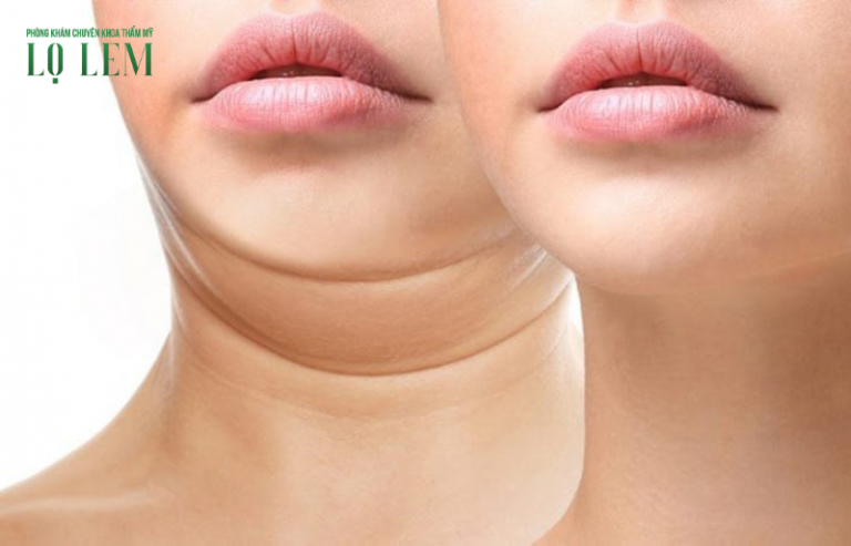 Lưu Nháp Tự động