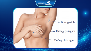 phẫu thuật thẩm mỹ tại bệnh viện Gangwhoo