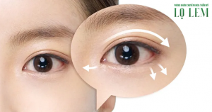 Sửa mí hỏng ở đâu uy tín TP.HCM?