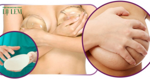 Hút Mỡ Toàn Thân Bao Nhiêu Tiền? Giá Cụ Thể Tại Nơi Uy Tín