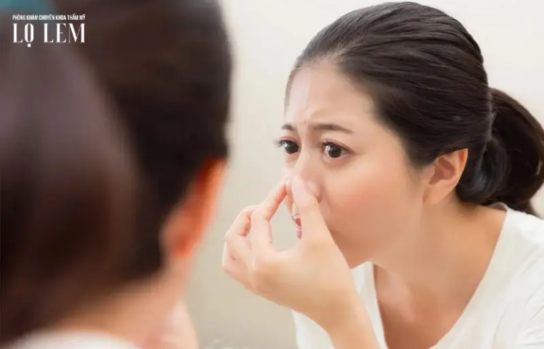 Nâng Mũi Sau 1 Tháng Còn Sưng Có Cần Sửa Không?