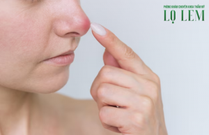 Nâng Mũi Bị Bóng đỏ đầu Mũi Phải Làm Sao? Địa Chỉ Uy Tín Tại Tân Bình